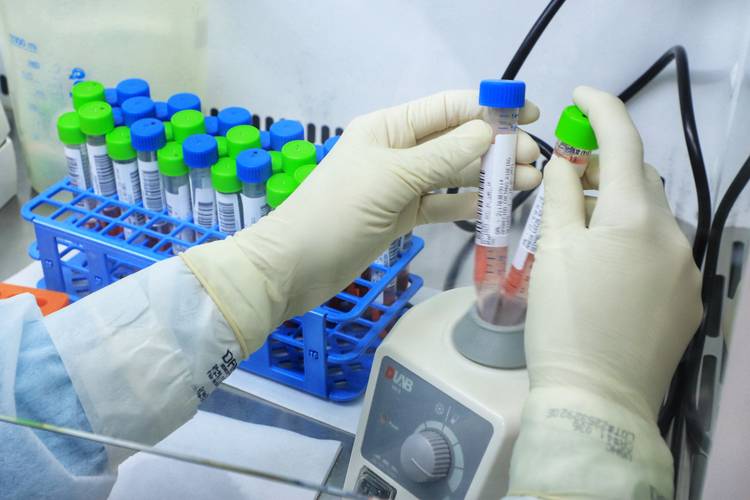 Hospital Universitário de Maringá realiza 6 mil testes para Covid-19