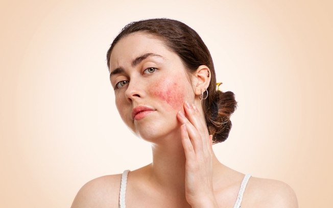 Descubra 3 fatores que deixam a pele mais irritada e sensível