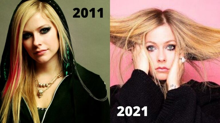 “Efeito Avril Lavigne”: o que contribui e atrapalha para manter a pele jovial