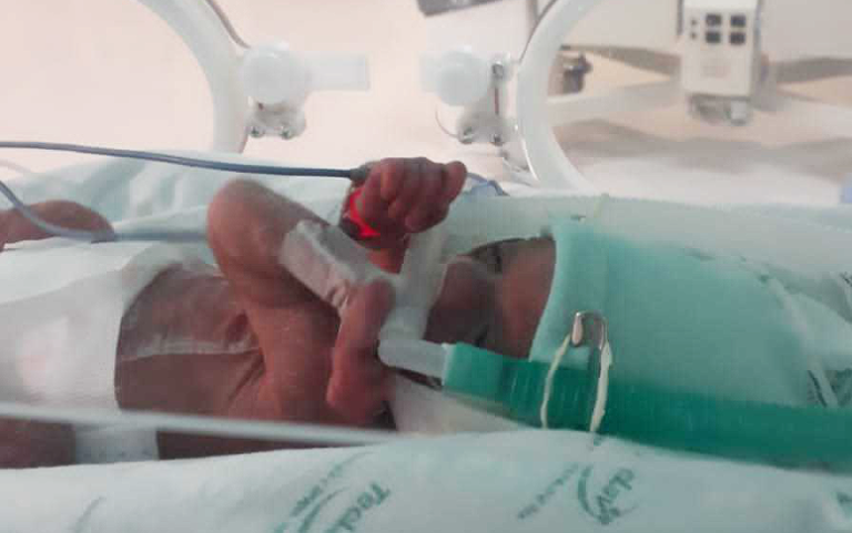 Tecnologia não-invasiva reduz em mais de 50% intubação de bebês no HRN