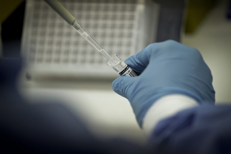 Laboratório Central acompanha queda dos casos de covid-19 no DF