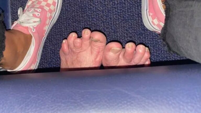 Mulher expõe pés feios de passageiro de trás no avião e choca internautas