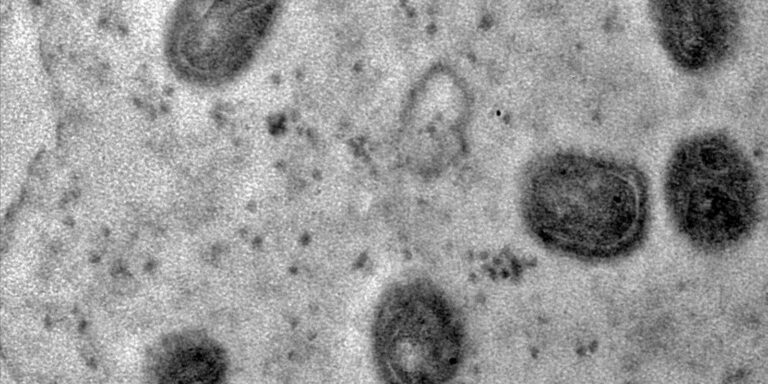 Fiocruz registra imagens de replicação do vírus monkeypox em célula
