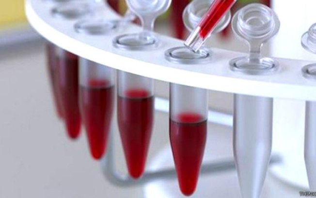 Exame de sangue pode indicar se paciente com Covid-19 precisará de respirador