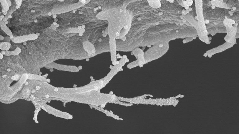Novo coronavírus: imagens microscópicas revelam tentáculos em células infectadas