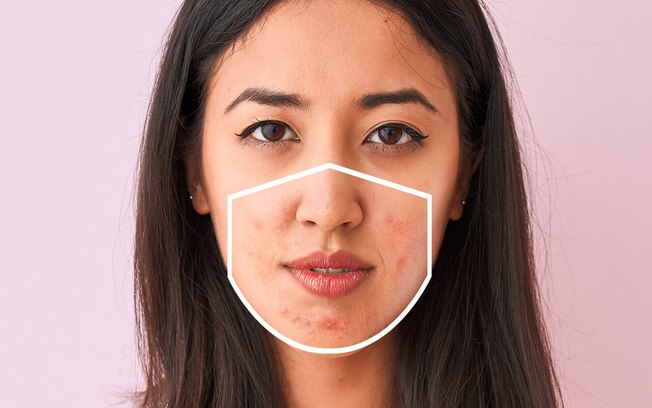 Como evitar a maskne, a acne gerada pelo uso excessivo de máscara
