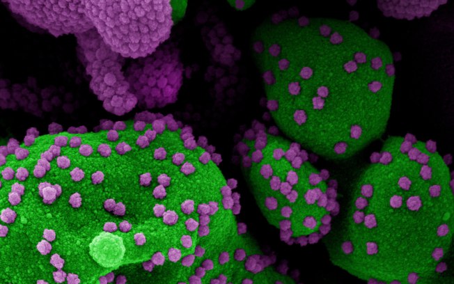 Cientistas descobrem novos anticorpos que neutralizam a Covid-19