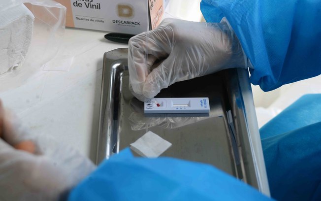 Teste de coronavírus RT-PCR em BH pode custar de R$ 249 a R$ 300