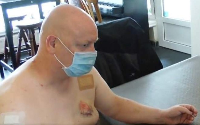 Homem é mordido no peito após demonstrar uso correto de máscara