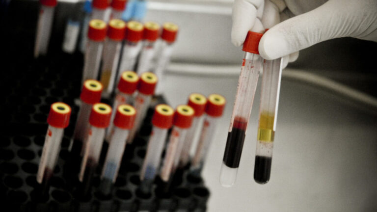 UBSs recebem 300 mil testes sorológicos; saiba quando fazê-lo