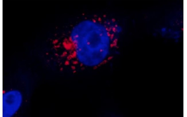 Com tecnologia barata, cientistas visualizam replicação de Covid-19 se em célula