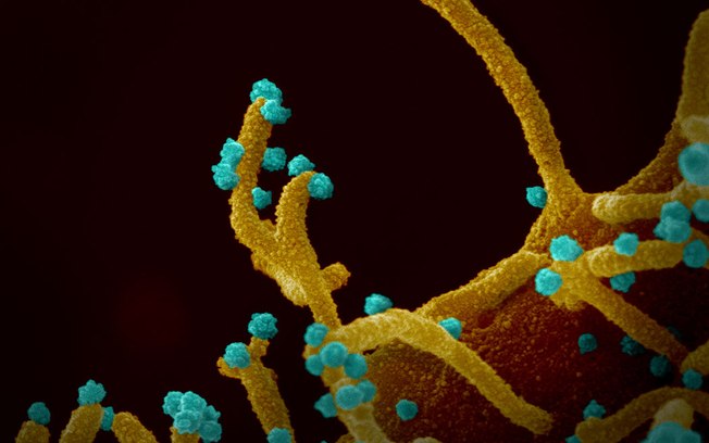 Covid-19: pesquisa Italiana identifica como vírus entra no sistema nervoso
