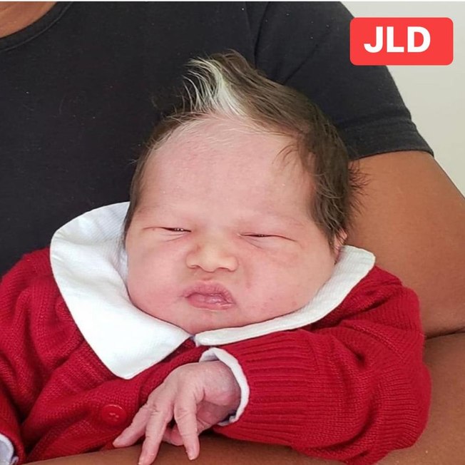 Bebê nasce com mecha no cabelo e vira sensação na internet