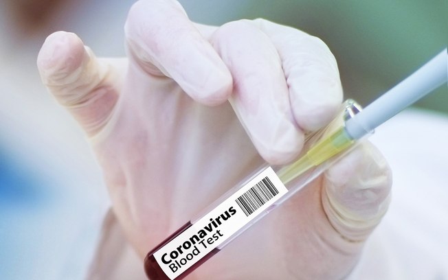 Mundo intensifica estratégias para obter vacina contra a Covid-19