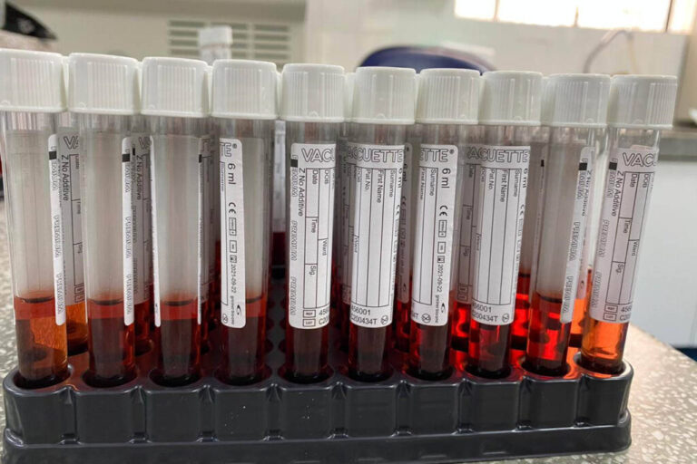 Saúde produz mais de 100 mil tubos para transporte viral de testes de Covid-19
