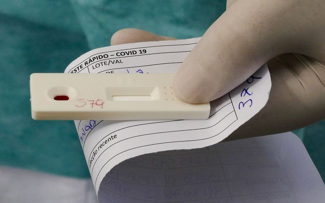 Nova etapa de testagem para novo coronavírus no Rio começa amanhã (30)