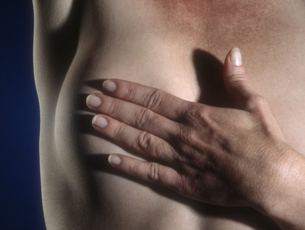 Mutirão para cirurgia de câncer de mama 