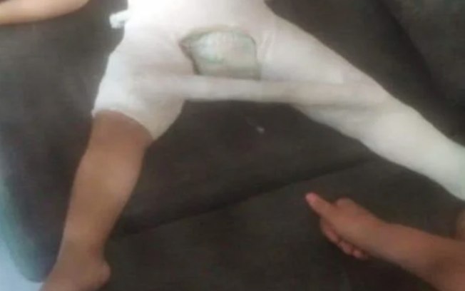 Mulher é presa por quebrar perna da filha de 3 anos