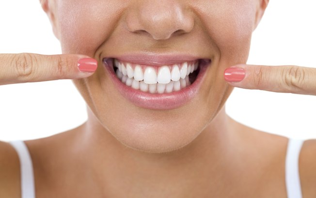 Aparelhos dentais invisíveis: entenda as diferenças e casos indicados