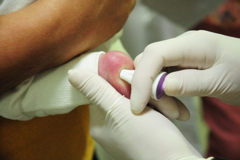 Hmib atendeu mais de 1,2 mil crianças com doenças raras