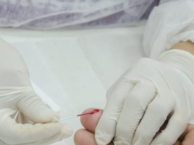 Dezembro Vermelho: Secretaria da Saúde conscientiza sobre prevenção e tratamento ao HIV/Aids