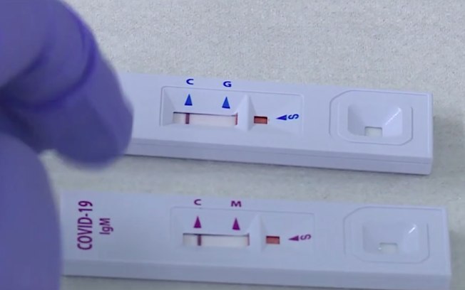 Covid-19: testes rápidos em farmácia tiveram pico na última semana de novembro