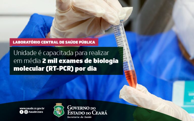 Lacen analisou mais de 200 mil exames para diagnóstico de Covid-19 durante a pandemia