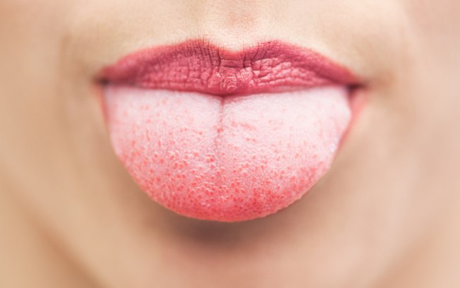 O que é a língua presa e quais são os tratamentos?